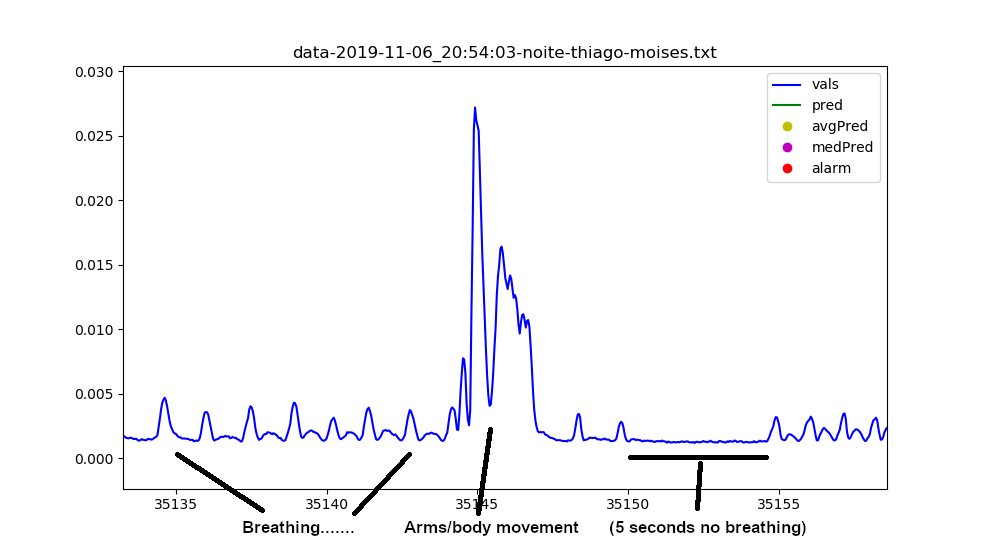 Detail of irregular (but normal) newborn's breathing pattern