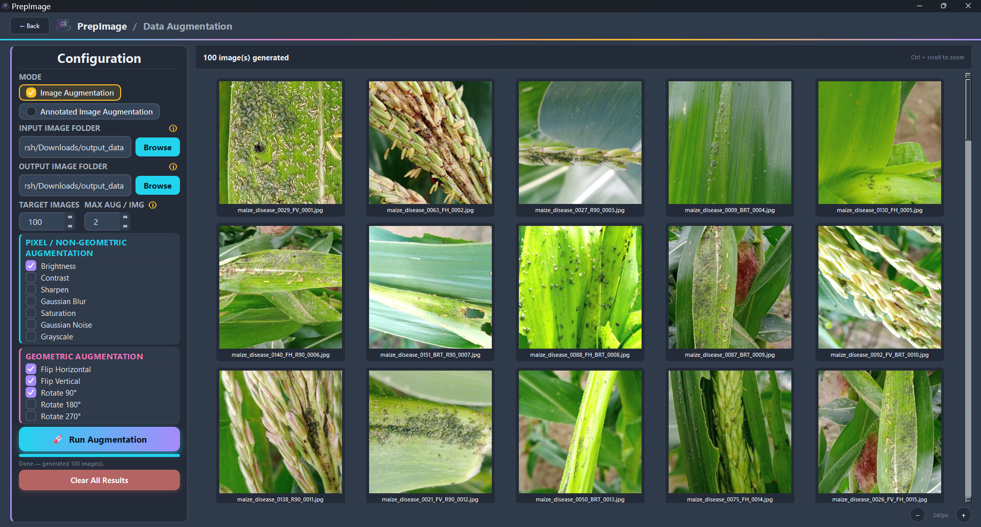 Image Augmentation screen
