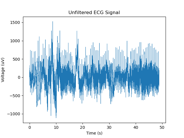 Unifiltered ECG Signal