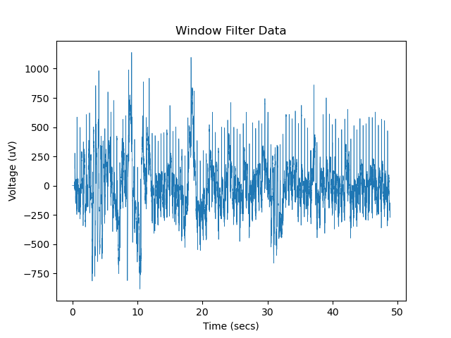 filtered ECG Signal