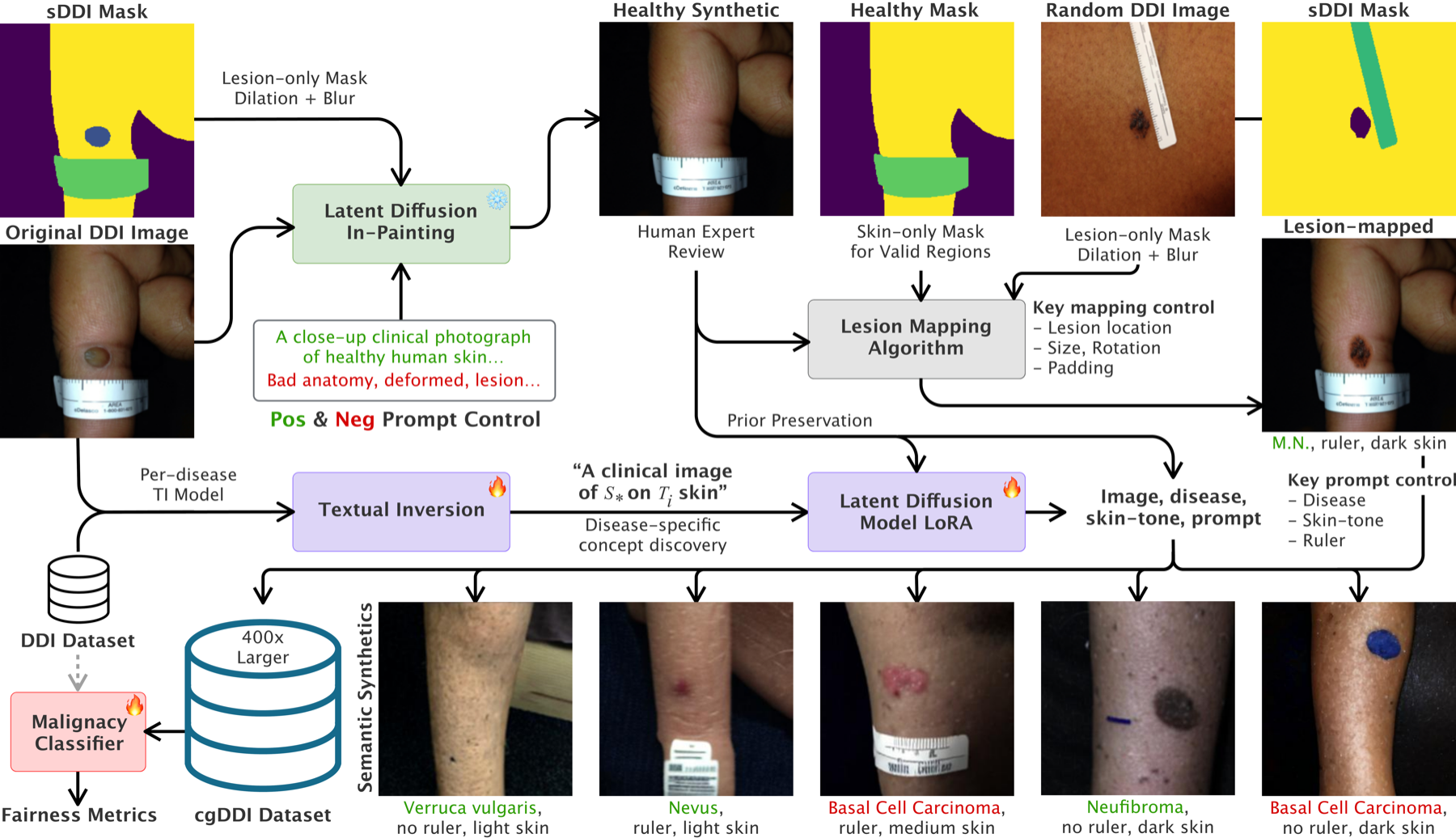 cgDDI framework: healthy synthetics, lesion-mapped synthetics, semantic synthetics, and fair classification