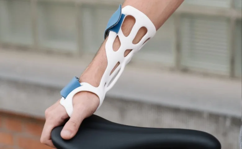 A 3D-printed arm brace