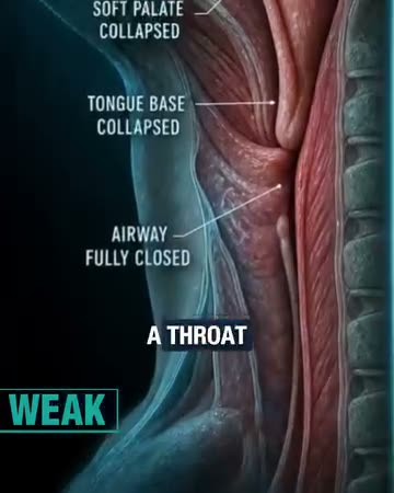 Sleepease ad