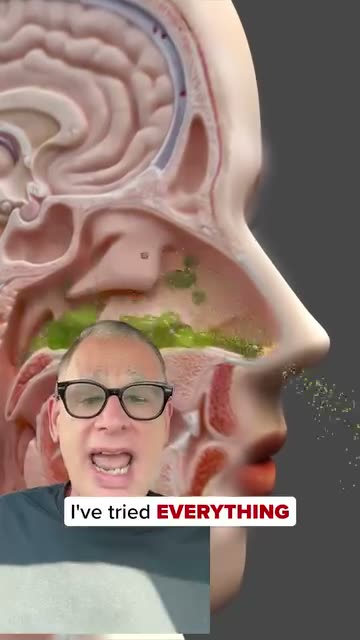 NasalFresh MD ad