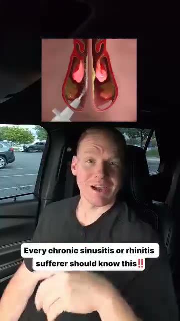 NasalFresh MD ad