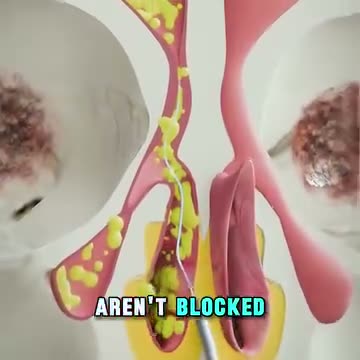 NasoFlow ad