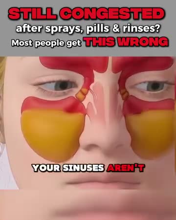 NasoFlow ad
