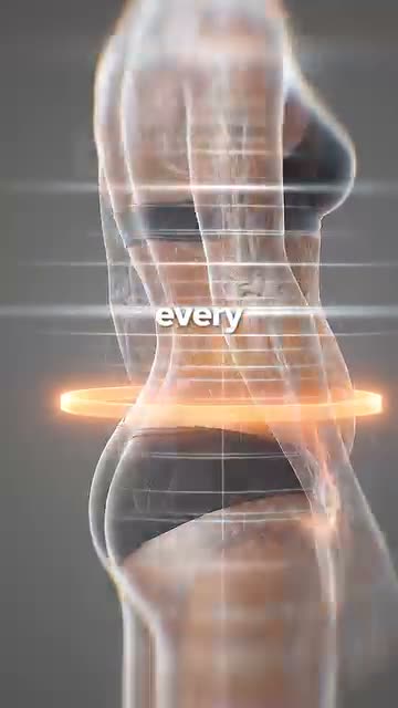 Arrae ad