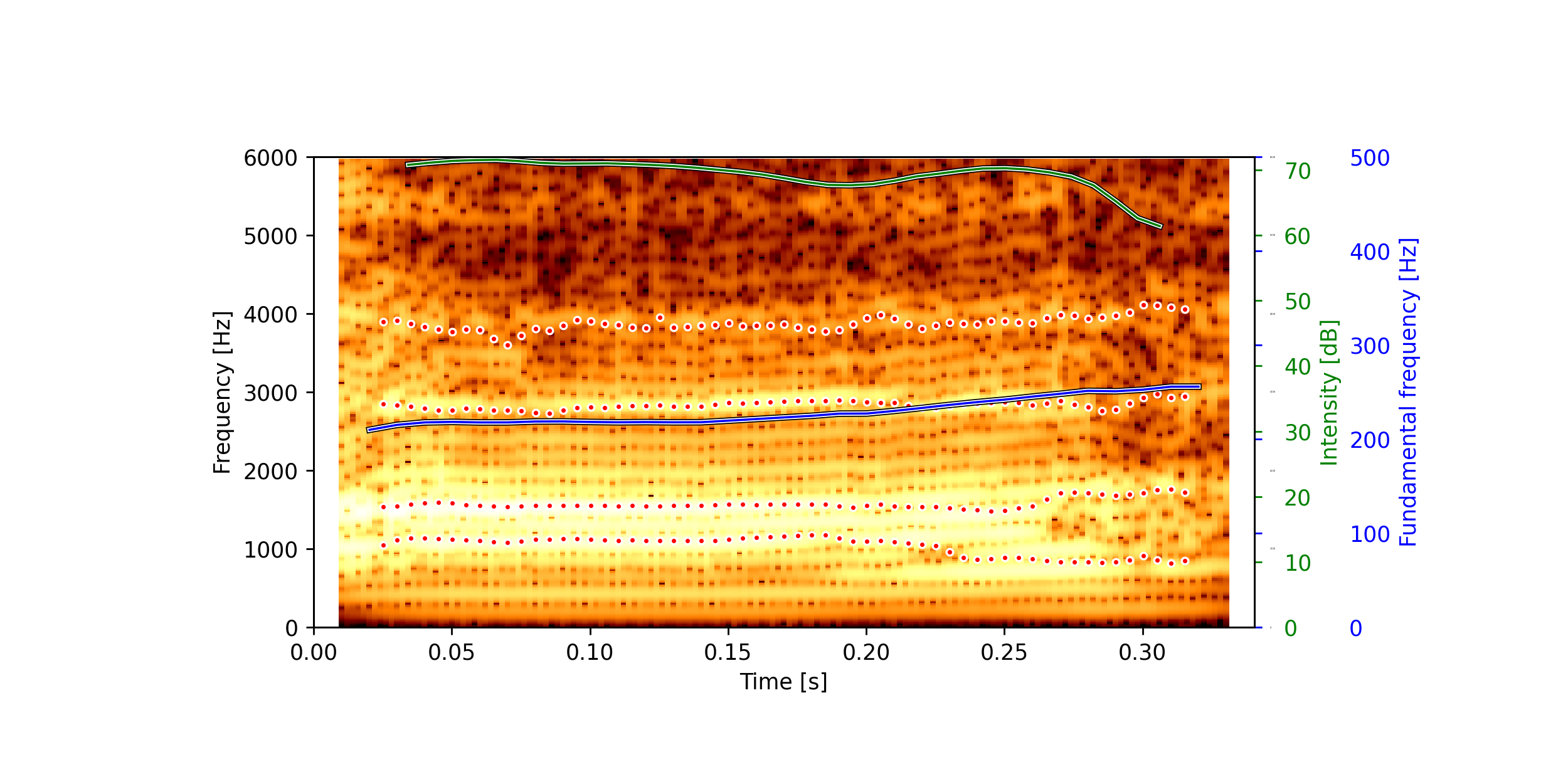 Spectrogram