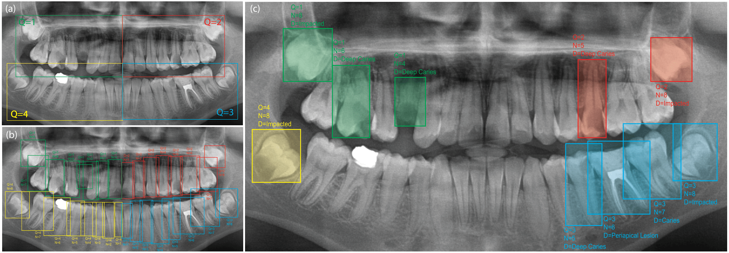 Fig. 2. The hierarchical organization of the annotated data. The data is structured into three levels: (a) quadrant-only for quadrant detection, (b) quadrant-enumeration for tooth detection, and (c) quadrant-enumeration-diagnosis for abnormal tooth detection.