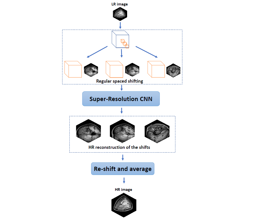 Operation method of SRCNN3D+RegSS