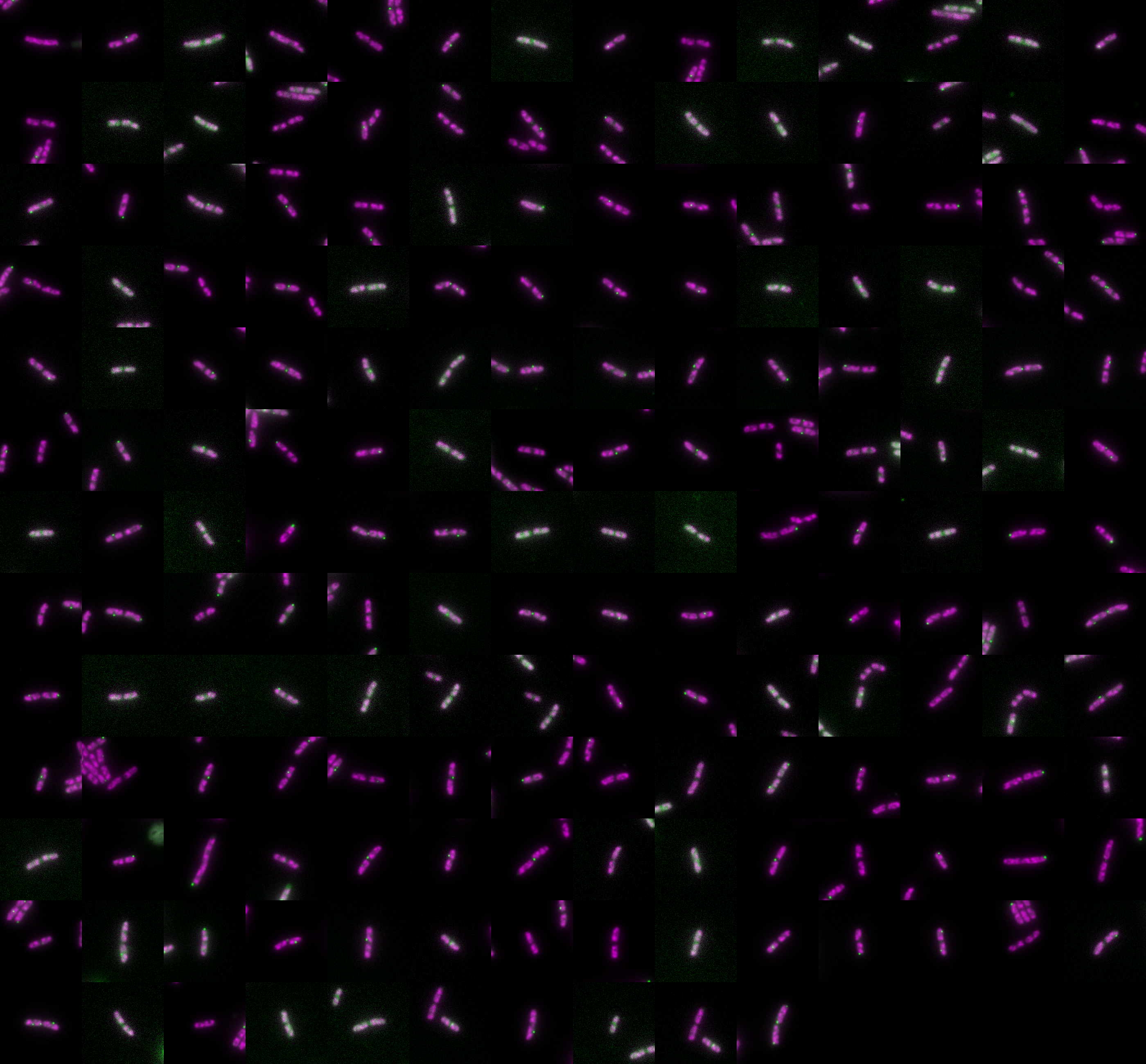 Manual Label 1 Overlay Fluo montage