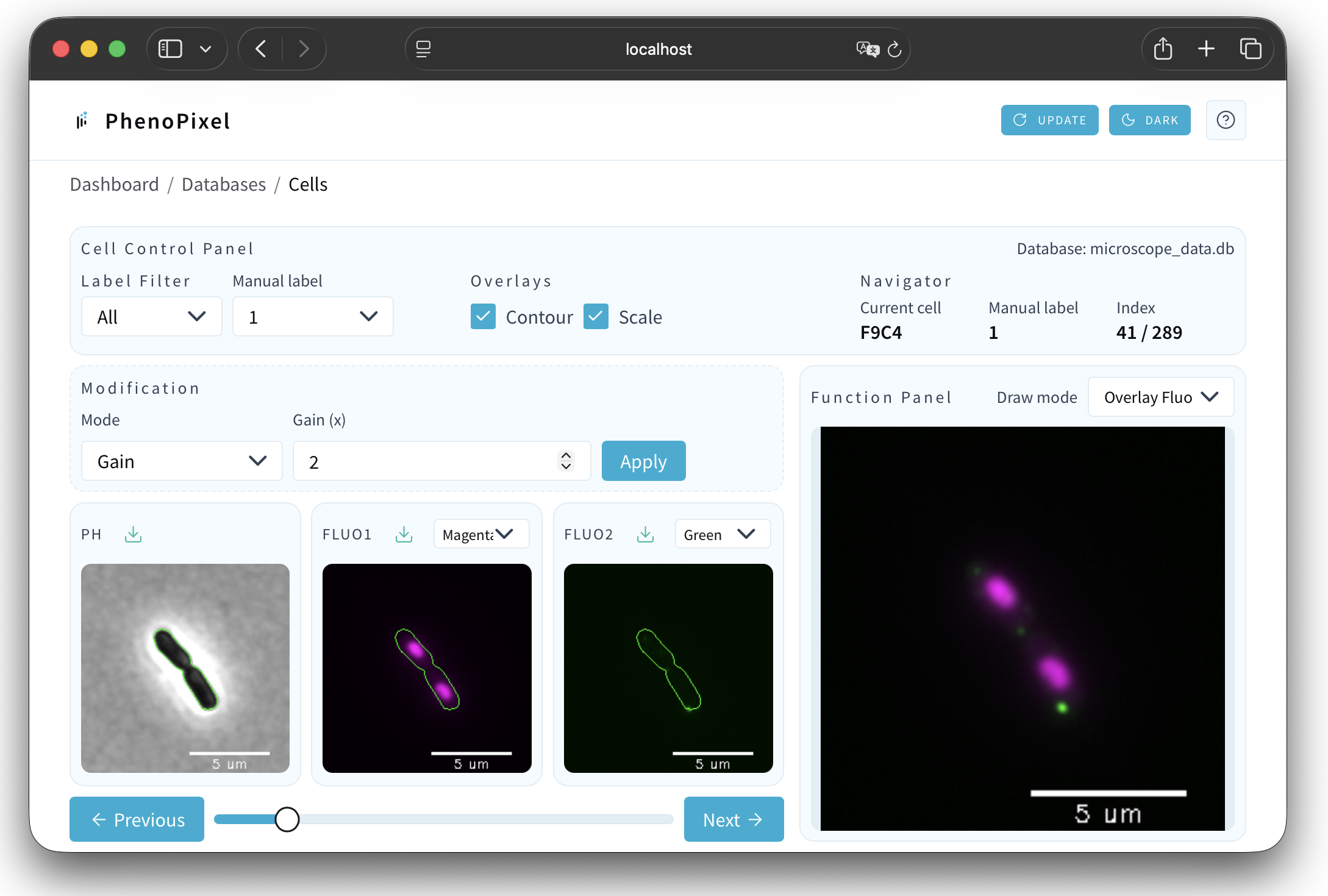 Fluorescence channel overlay