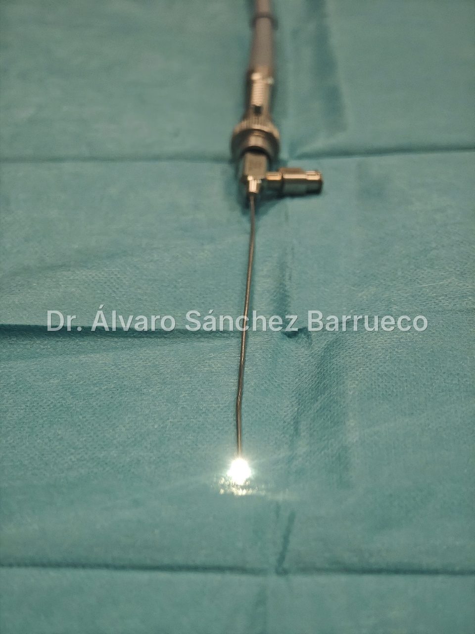 ¿Qué es la sialoendoscopia y para qué sirve?