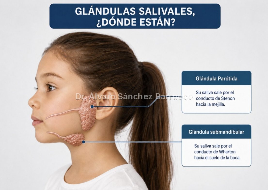 ¿Por qué mi hijo tiene paperas una y otra vez?