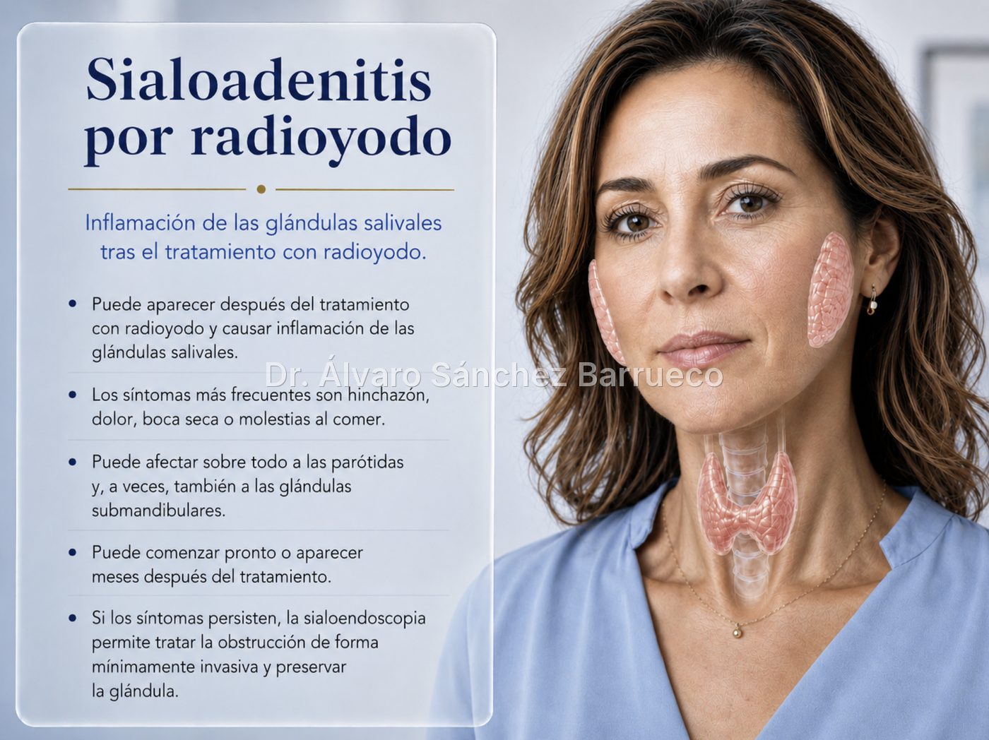 He tenido un cáncer de tiroides, ¿por qué se me inflaman las glándulas salivales después del radioyodo?