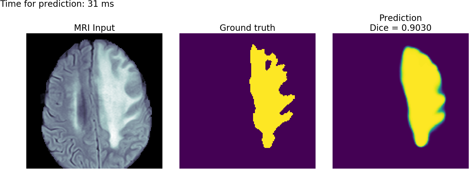 Brain Tumor Segmentations