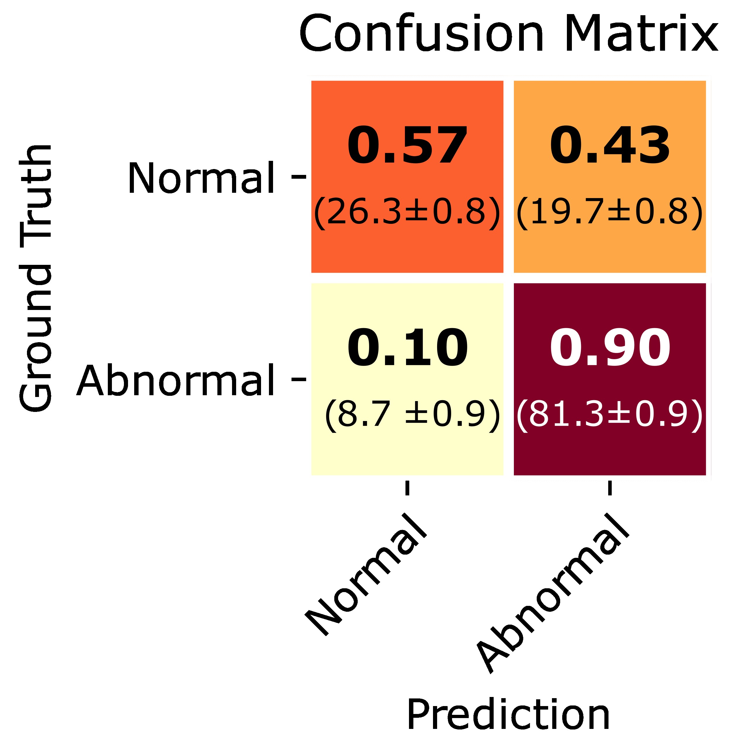abnormal-confusion-matrix