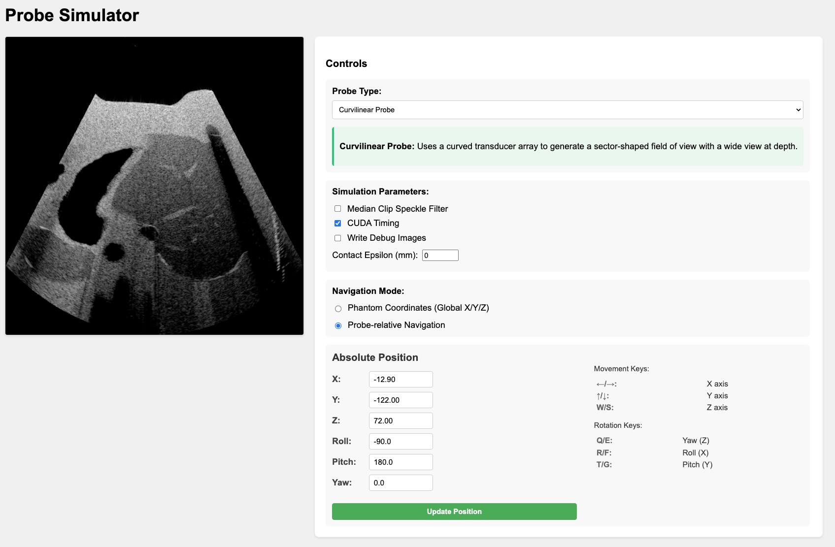 Ultrasound Probe Simulation