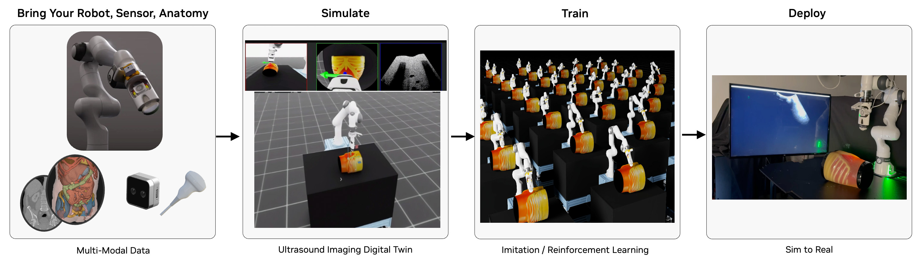 Robotic Ultrasound Workflow