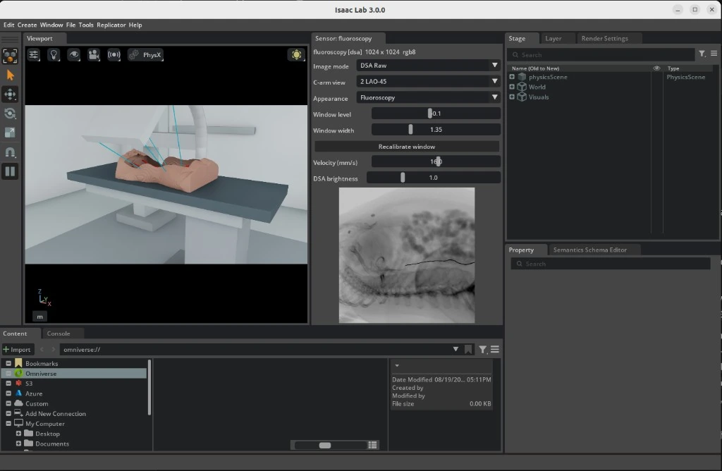 C-arm viewport beside the live fluoroscopy panel