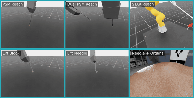 Laparoscopic robotics workflow evaluations