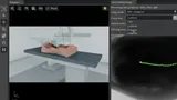 Fluoroscopy scene