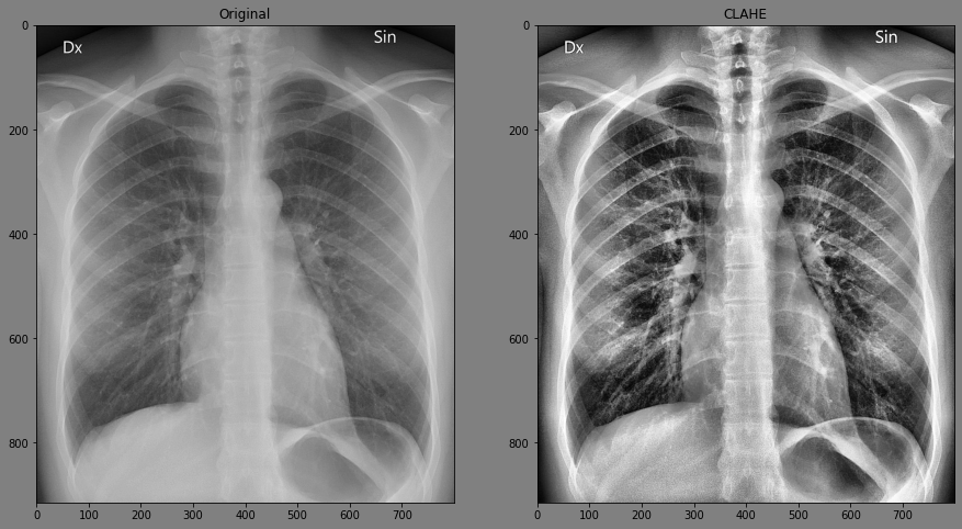 sidebyside example