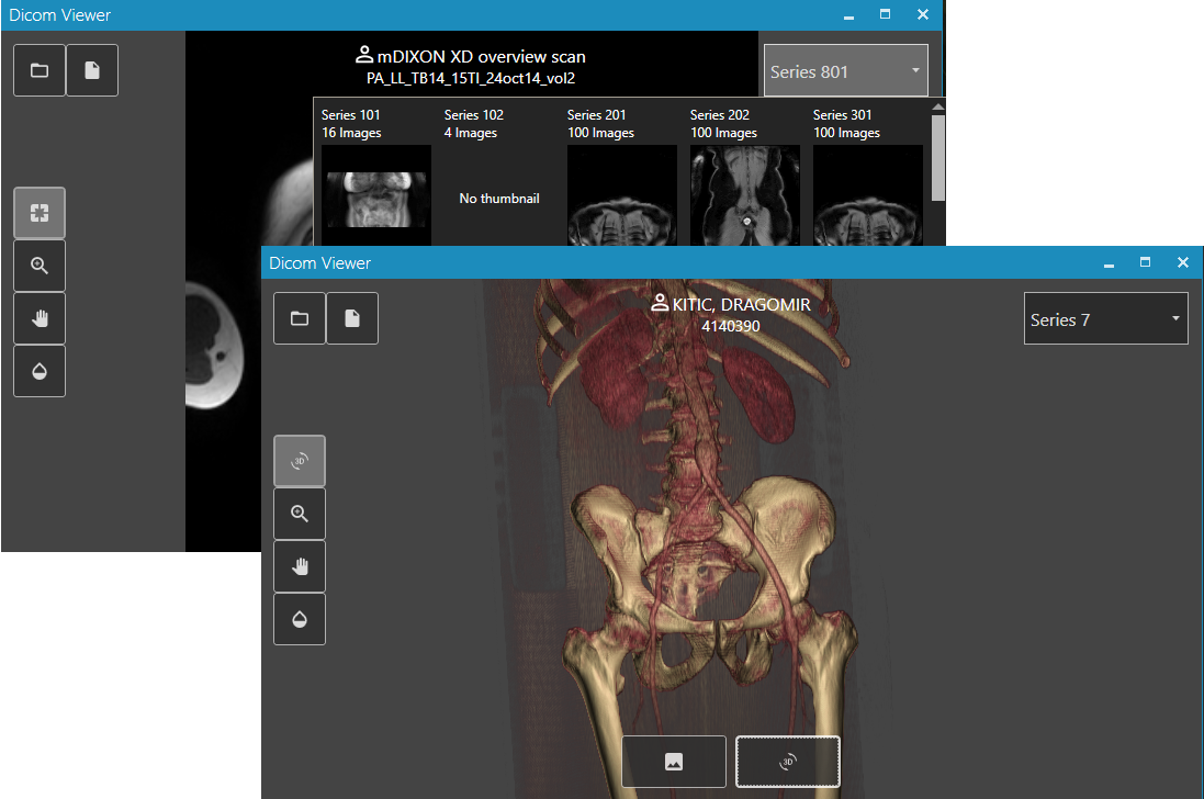 DICOM viewer