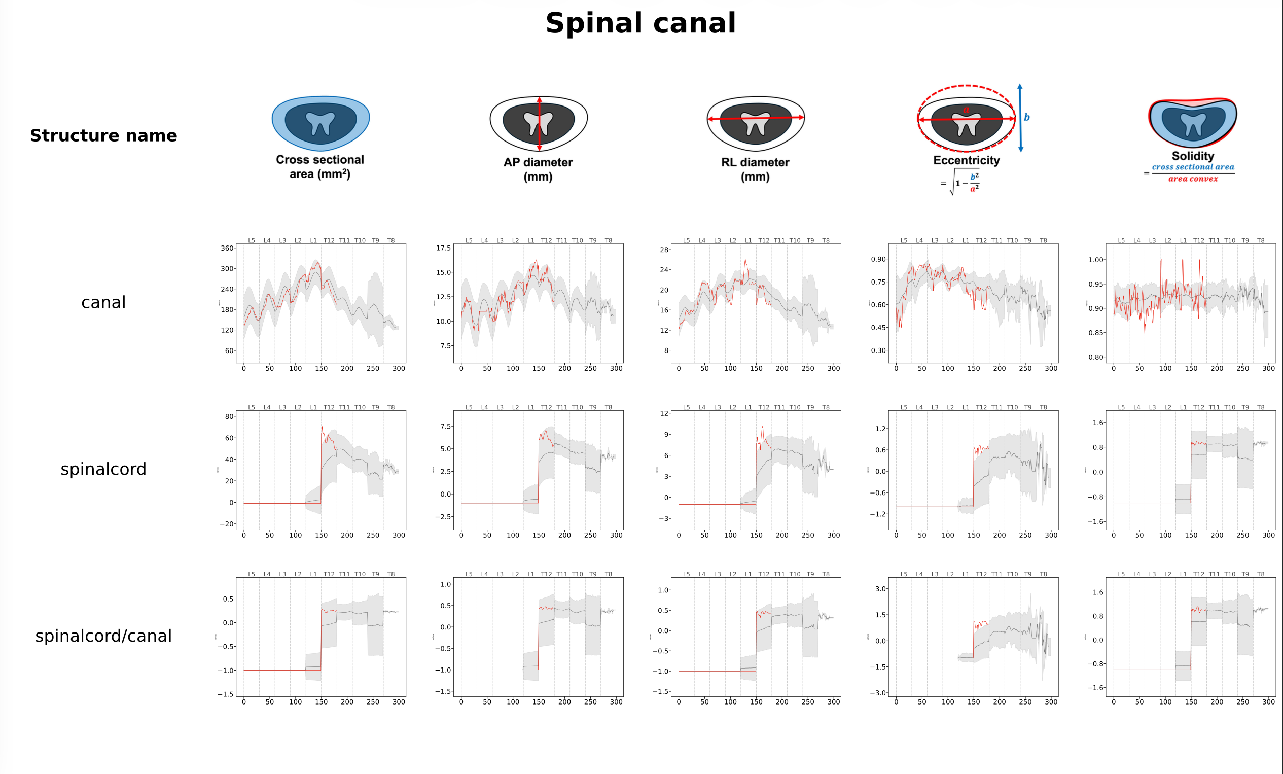 Report - Canal