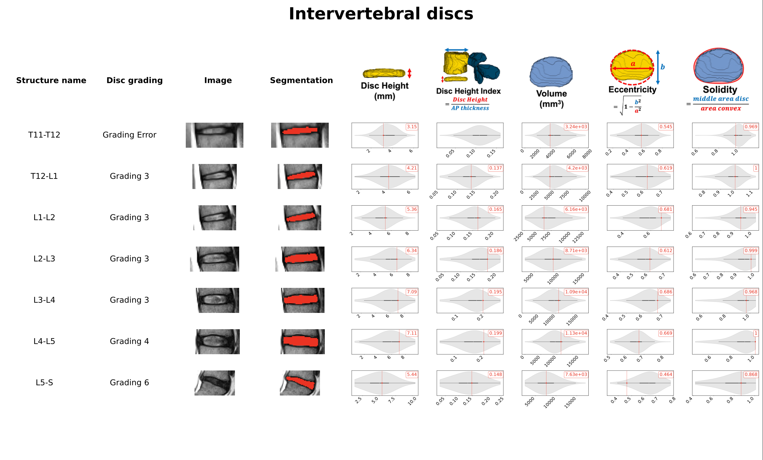 Report - Discs