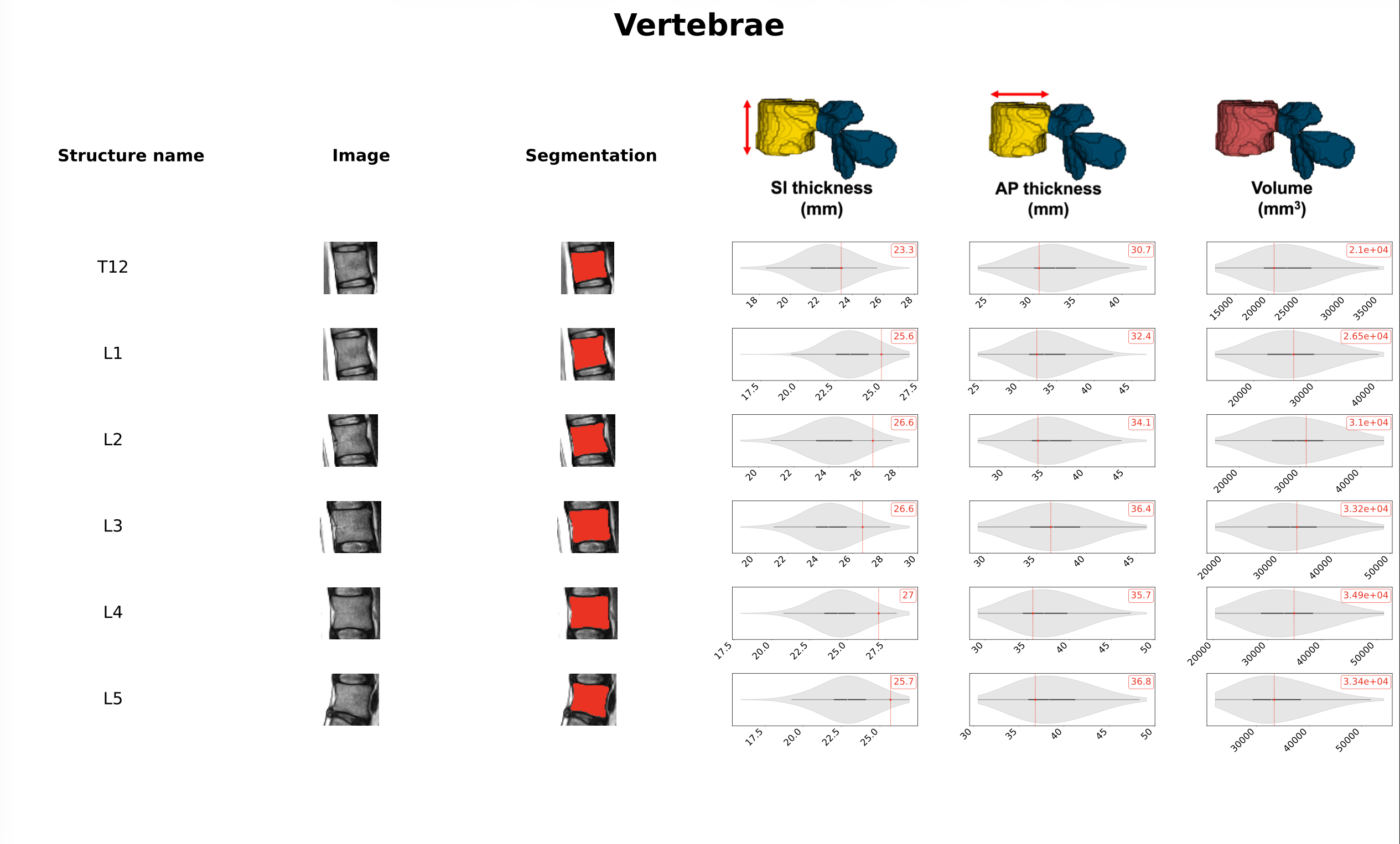Report - Vertebrae