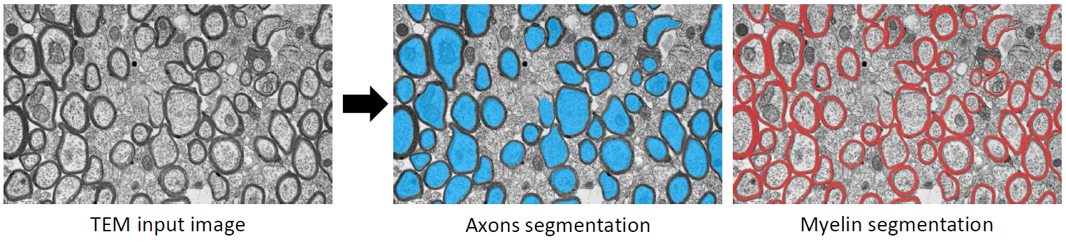 Figure of automatic axons and myelin segmentation on TEM input image