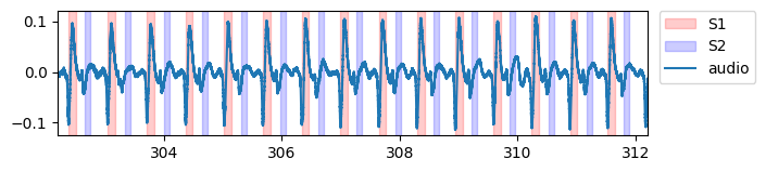 Audio with S1 and S2 periods