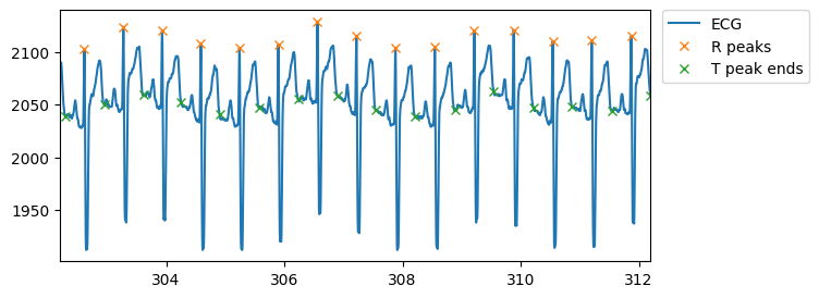 ECG with peaks