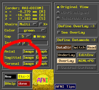 Image of AFNI controller