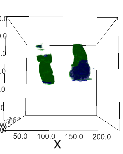 Prediction from 2D U-Net (ResNet34)