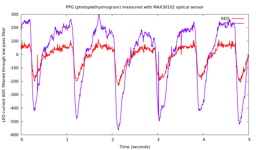 PPG trace from MAX30102 sensor