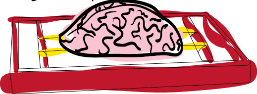 Brain rack