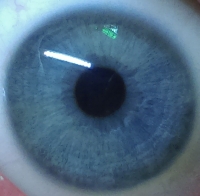 Iris