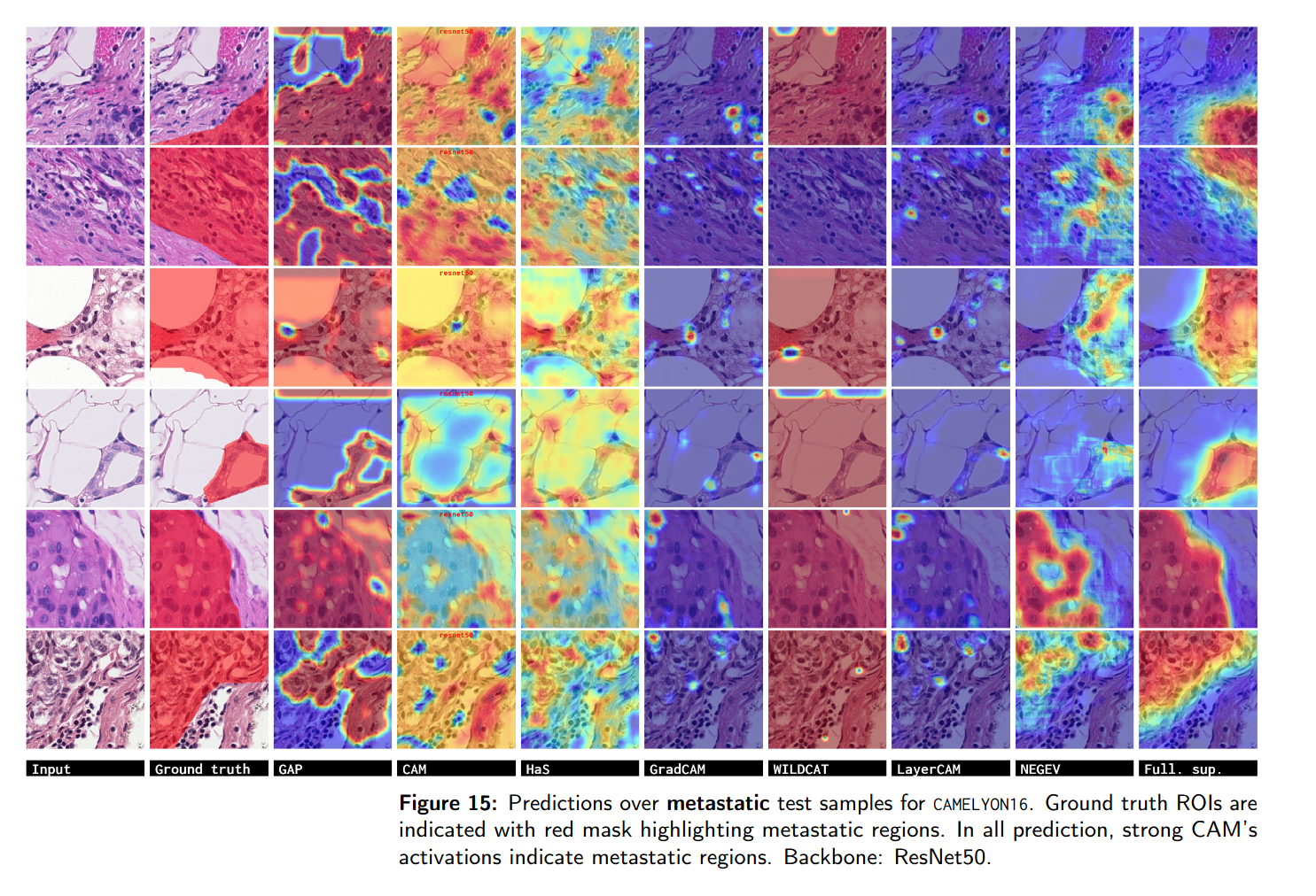 localization Camelyon16 dataset, Metastatic.