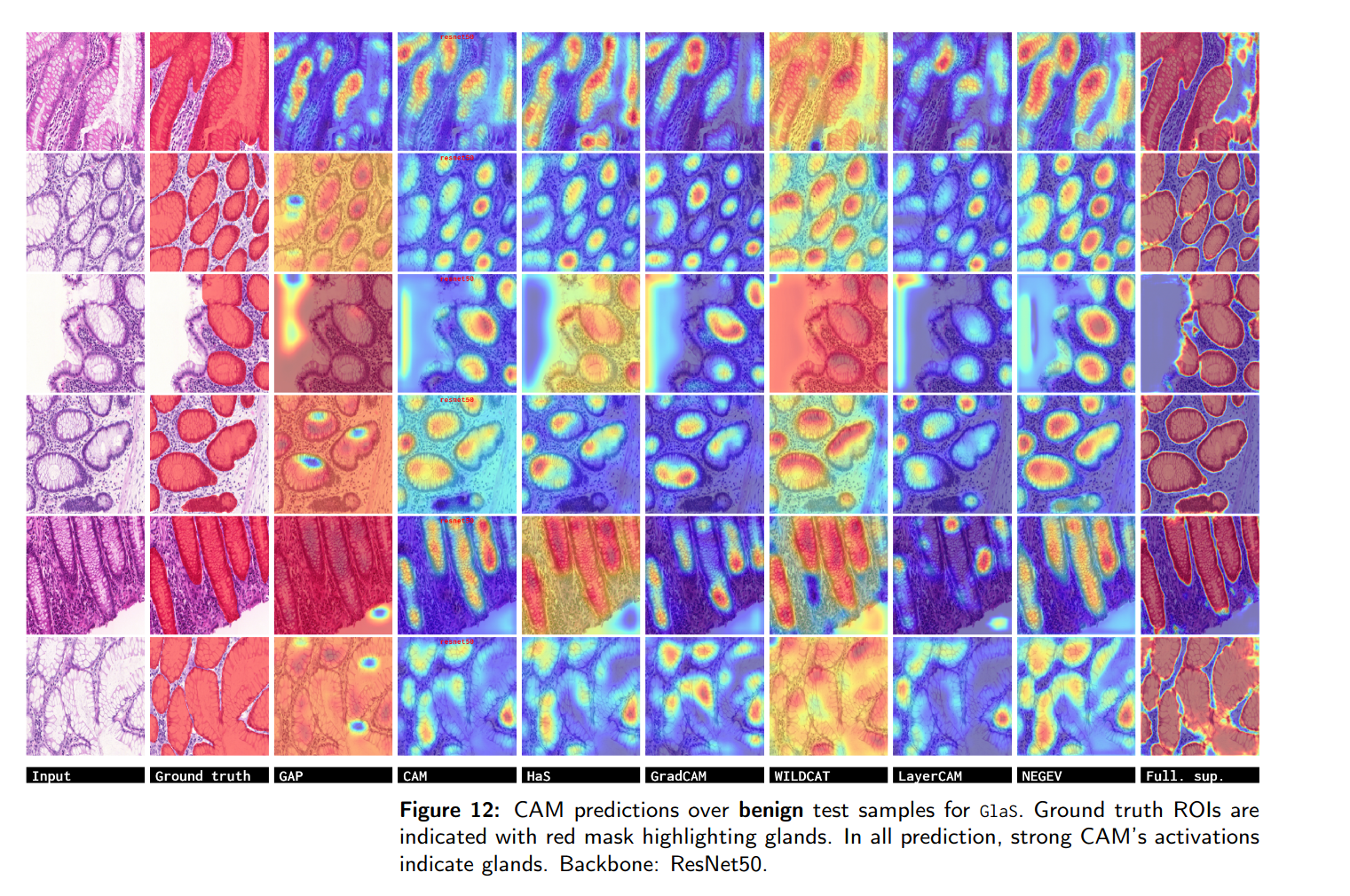 localization GLAS dataset, Benign.