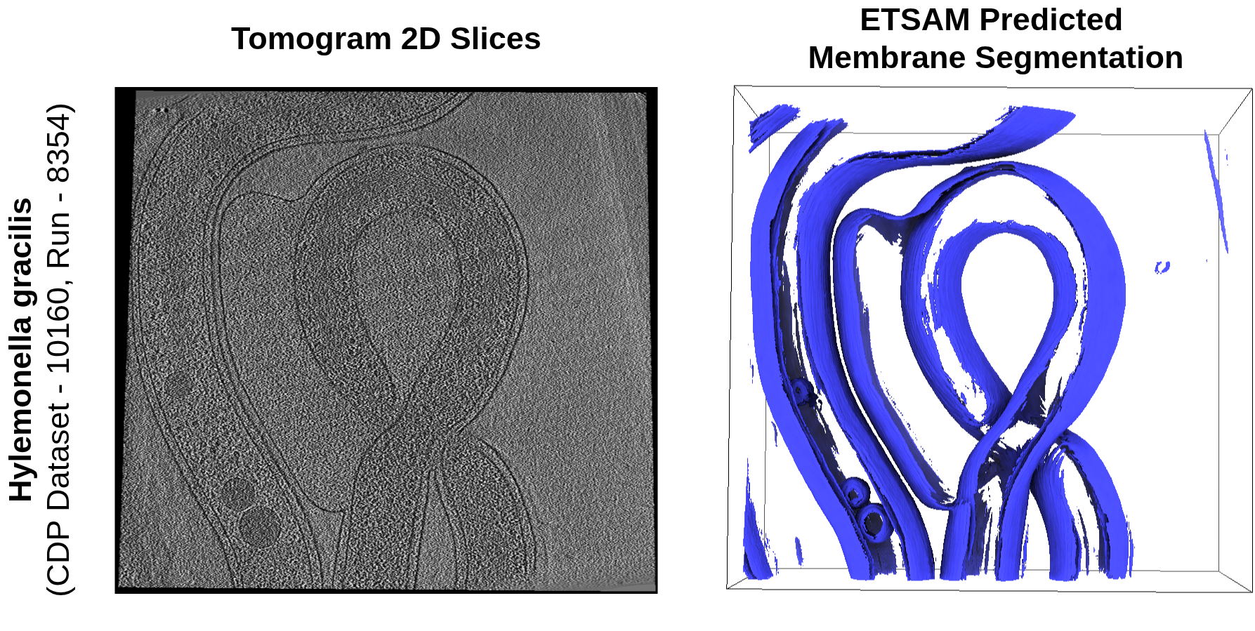 ETSAM segmentation result for Hylemonella gracilis