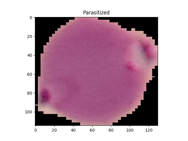 malaria-cell-detection-image-classifier