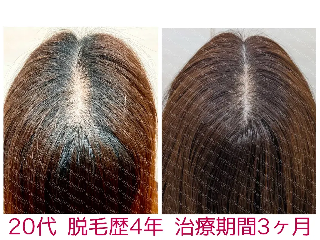 症例3