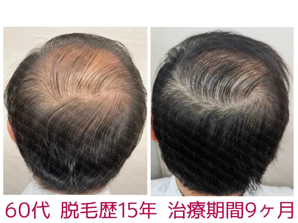 症例4