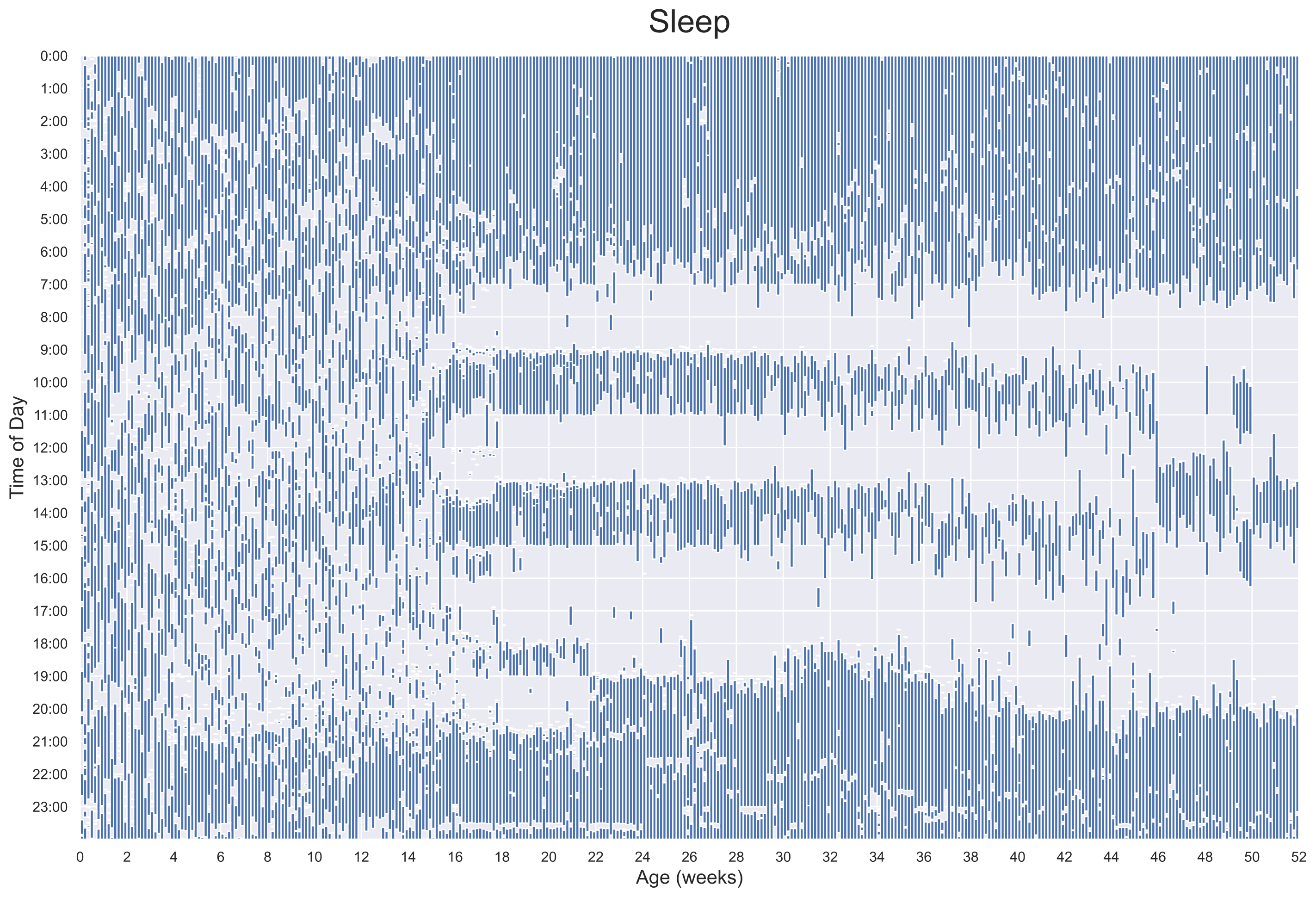 Sleep Visualization