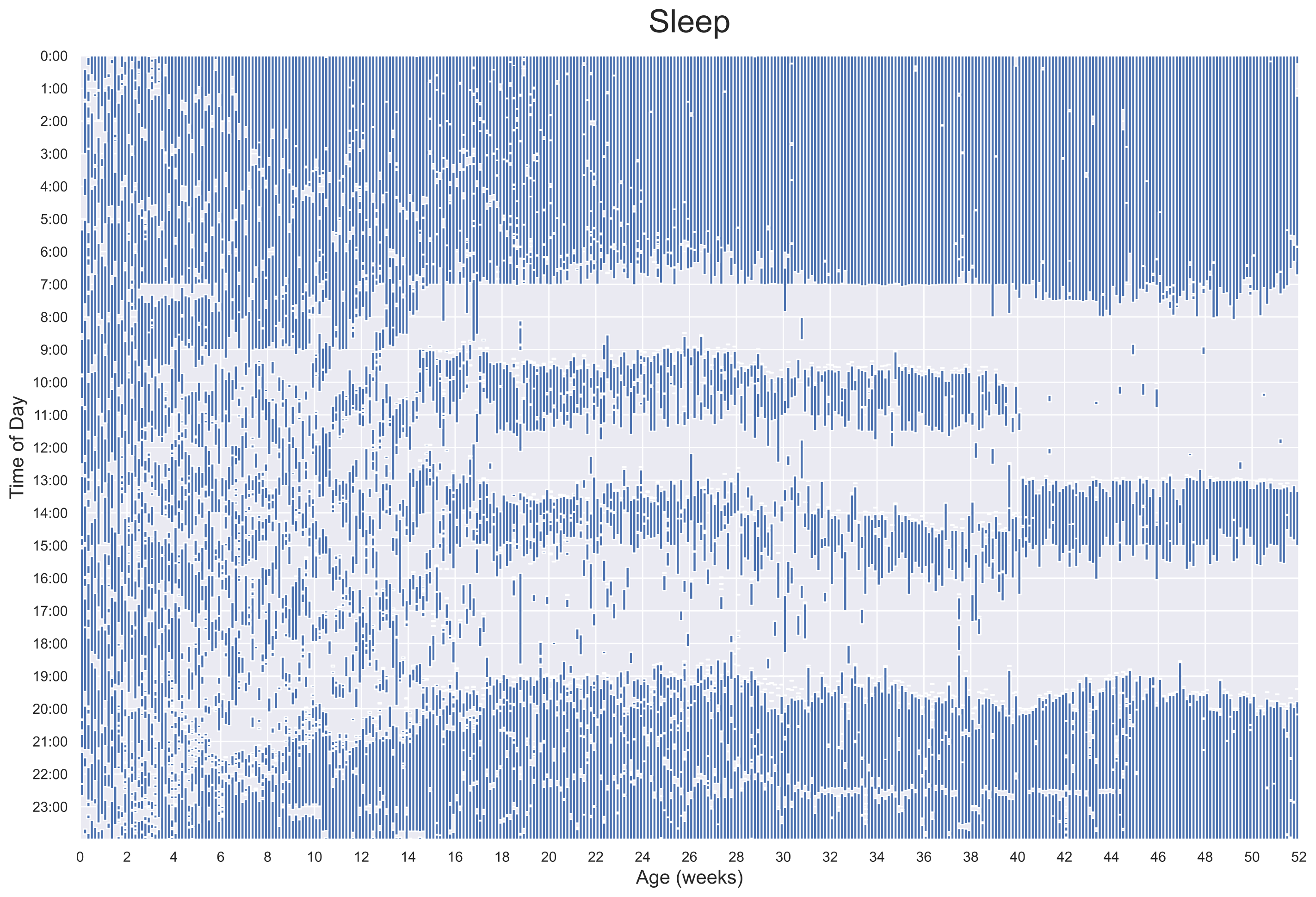 Sleep Visualization