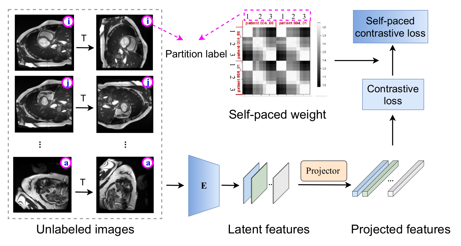 self-paced-contrastive-learning-for-semi-supervised-medical-image