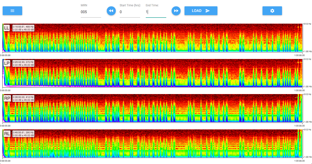 eeg-vizsg-lat-prestige-mag-nk-rh-z